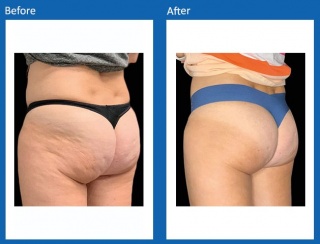 Tone & Sculpt