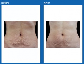 Tone & Sculpt