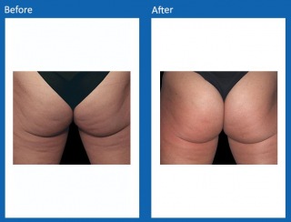 Tone & Sculpt
