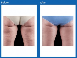 Tone & Sculpt